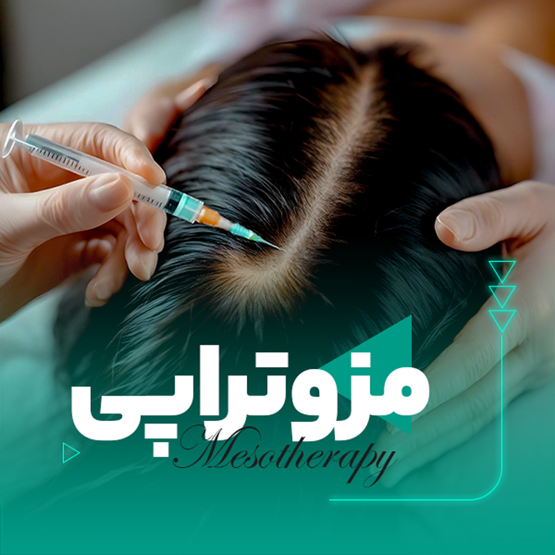 مزوتراپی